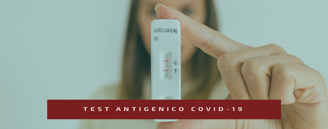 Slide test antigenico covid-19