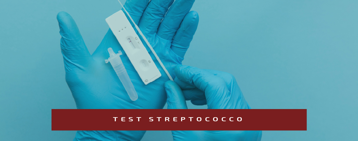 Slide test streptococco